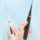 💎Surprise Price ￡9.99!!🦷✨Electric Ultrasonic Dental Scaler for Tartar and Plaque Removal