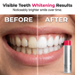 😁LAST DAY SALE £9.99!!🦷✨ Stain‑Removing Whitening Mouthwash – Lifts coffee & tea stains, alcohol‑free. Instant gunk binding, long‑lasting minty fresh. Gentle enough for daily use. 💙
